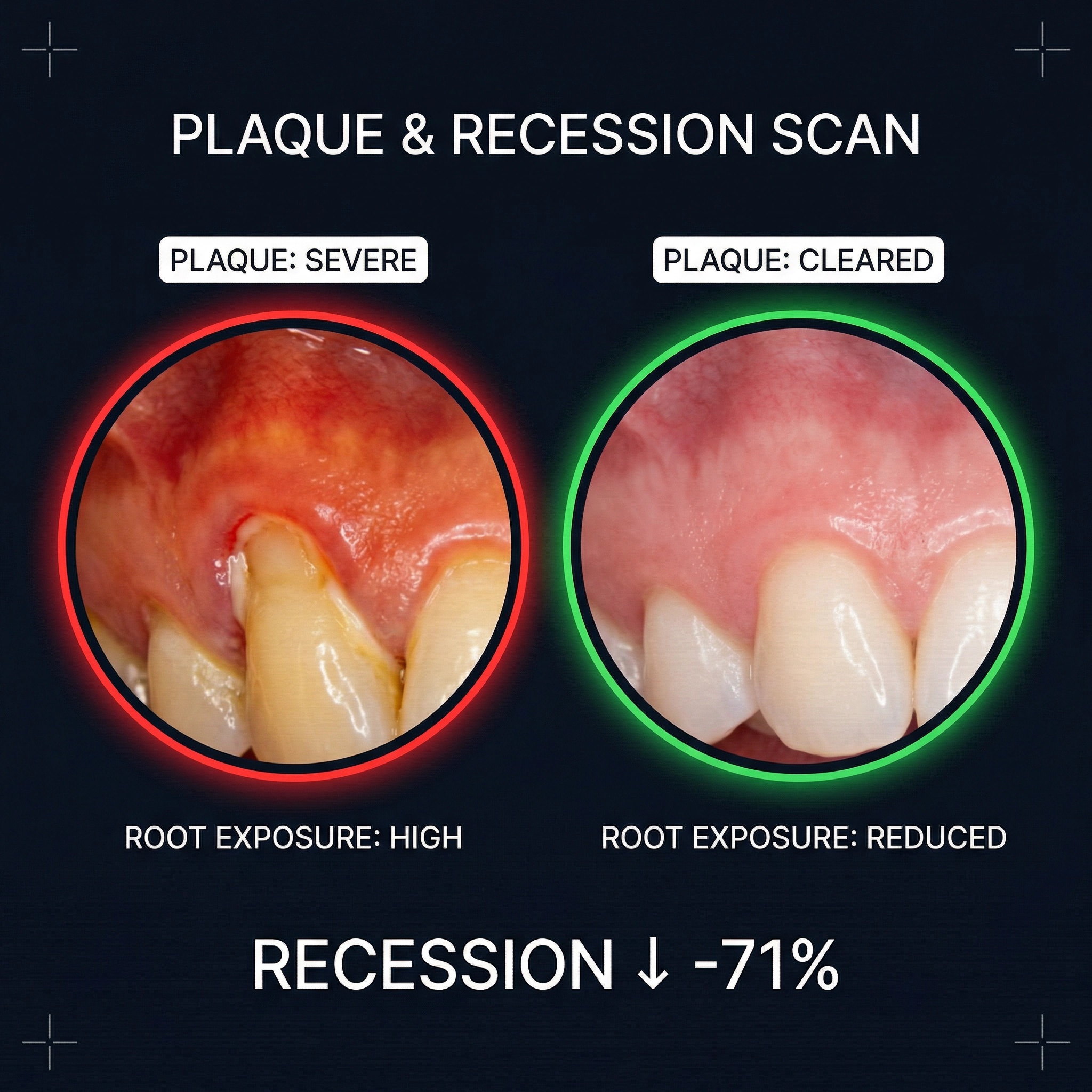 Receding Gums Reset Facebook ad