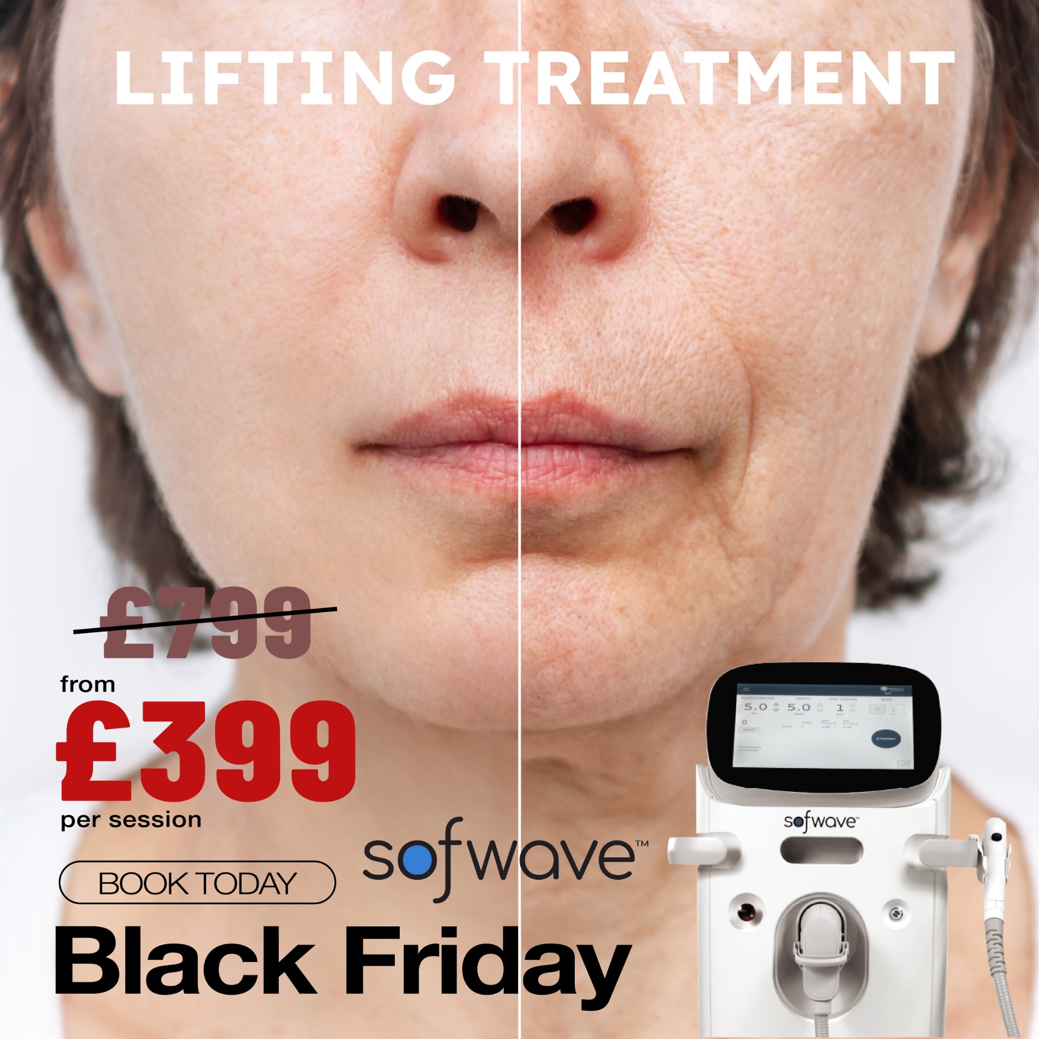 EC Aesthetic Clinic Facebook ad
