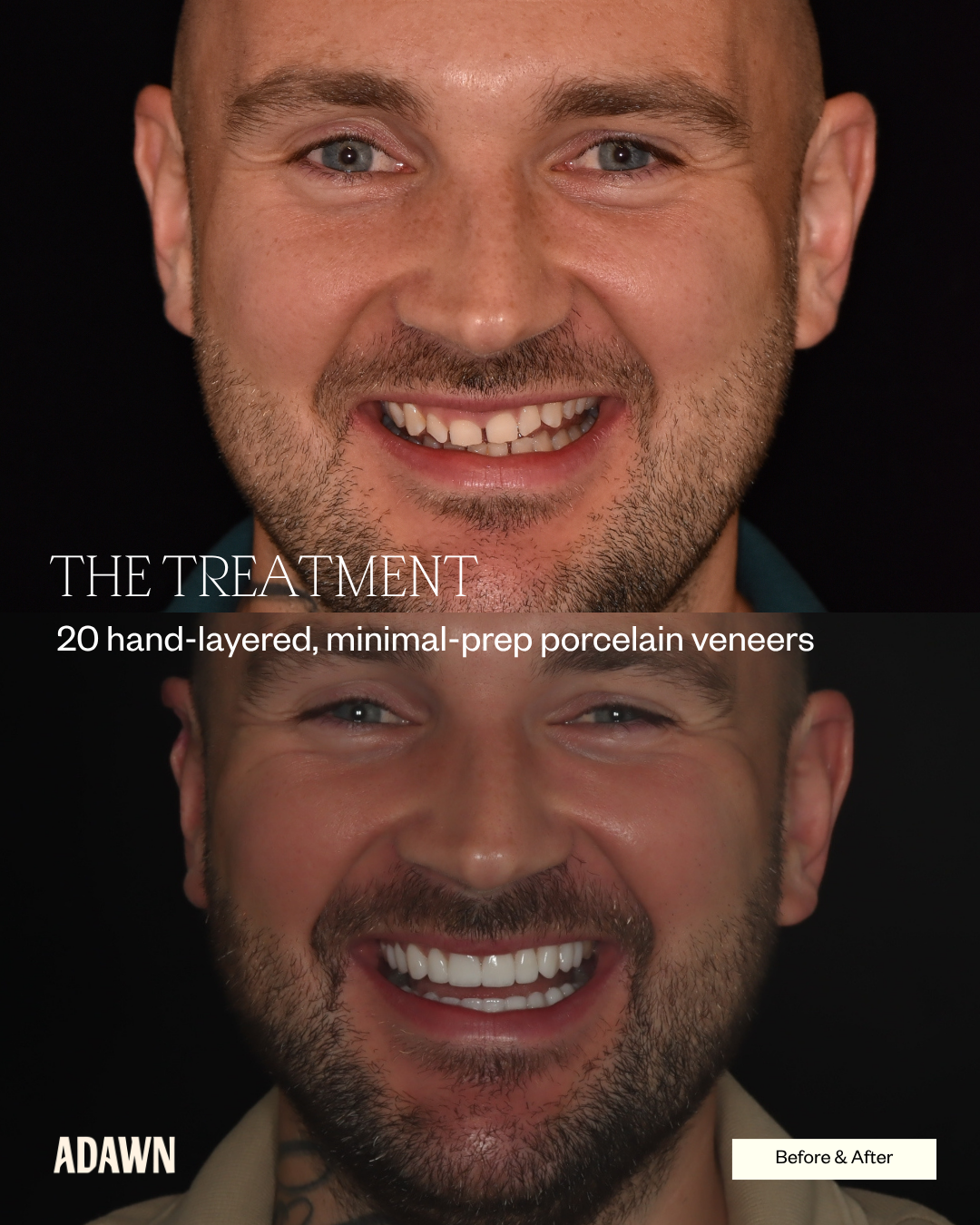 Adawn Dental Studio Facebook ad