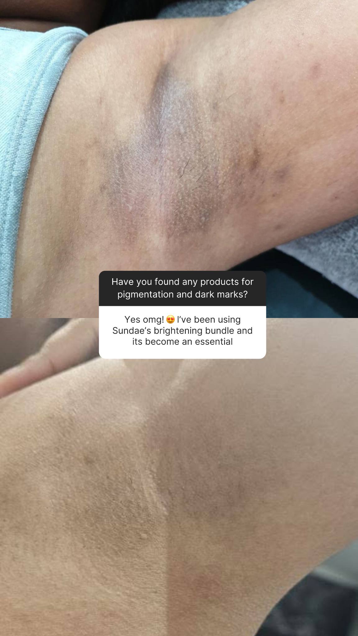 Sundae Skin Co Facebook ad