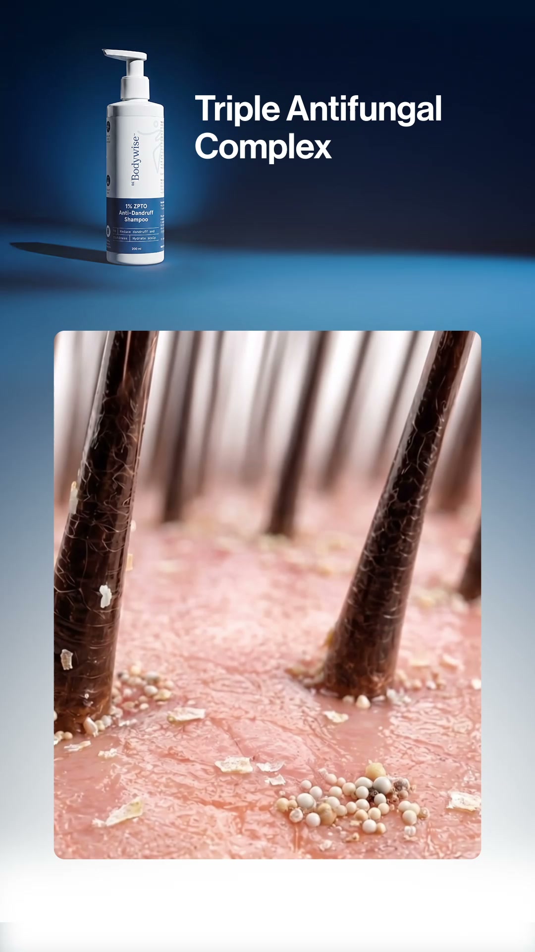 Be Bodywise - UAE Facebook ad: Treat Dandruff at the Root