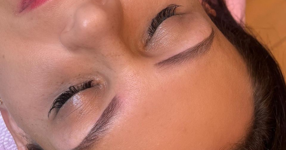 Laser-Clinic Radom Facebook ad: Salon Kosmetologii Profesjonalnej Laser Clinic Radom…