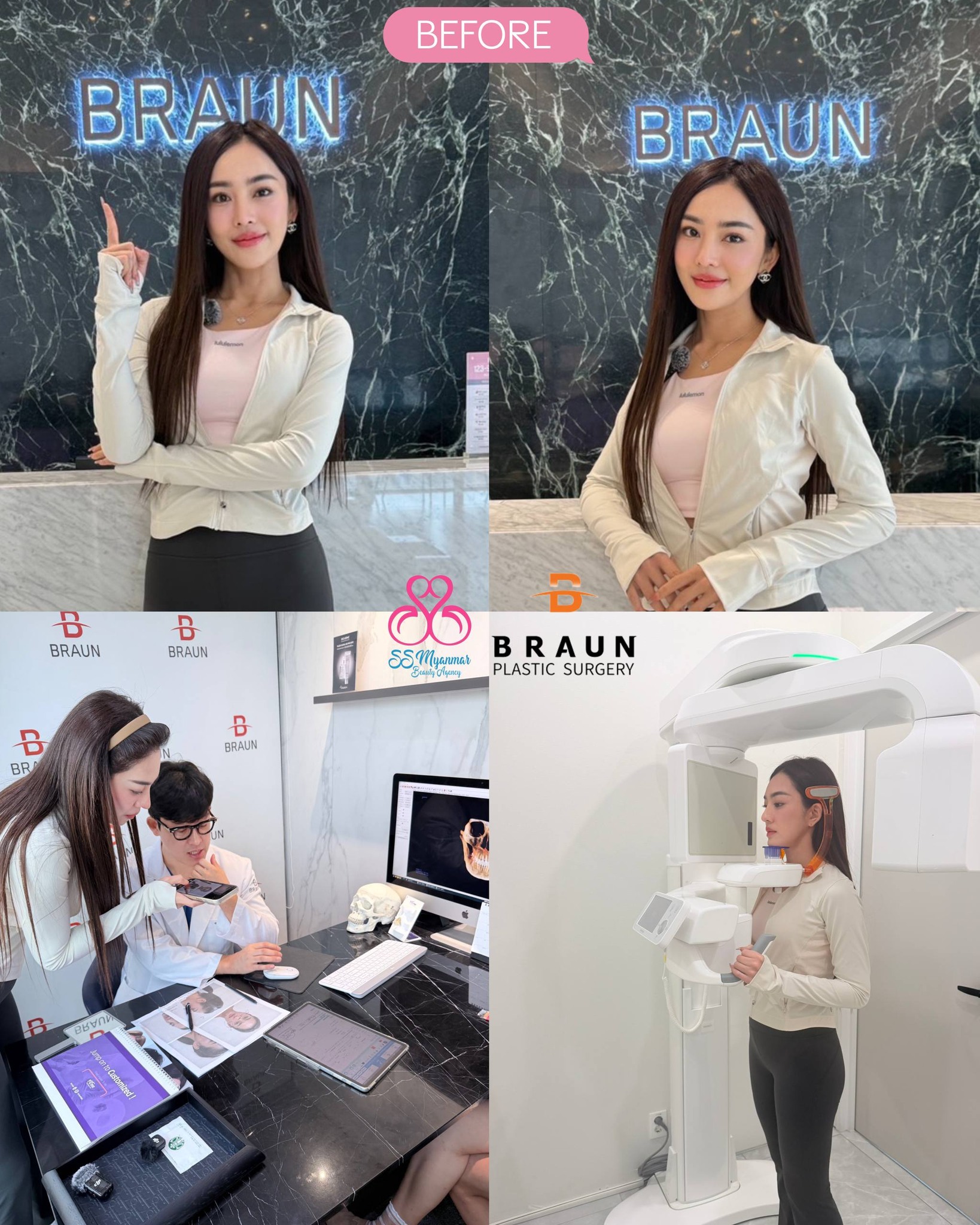 SS Myanmar Beauty Agency Facebook ad: K.SENDAI BEAUTY UPDATE, Full Face Transformation in Korea