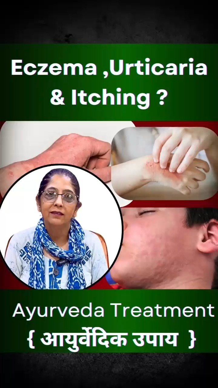 Chandigarh Ayurved Centre Facebook ad: Geetanjali had been suffering from skin problems for…