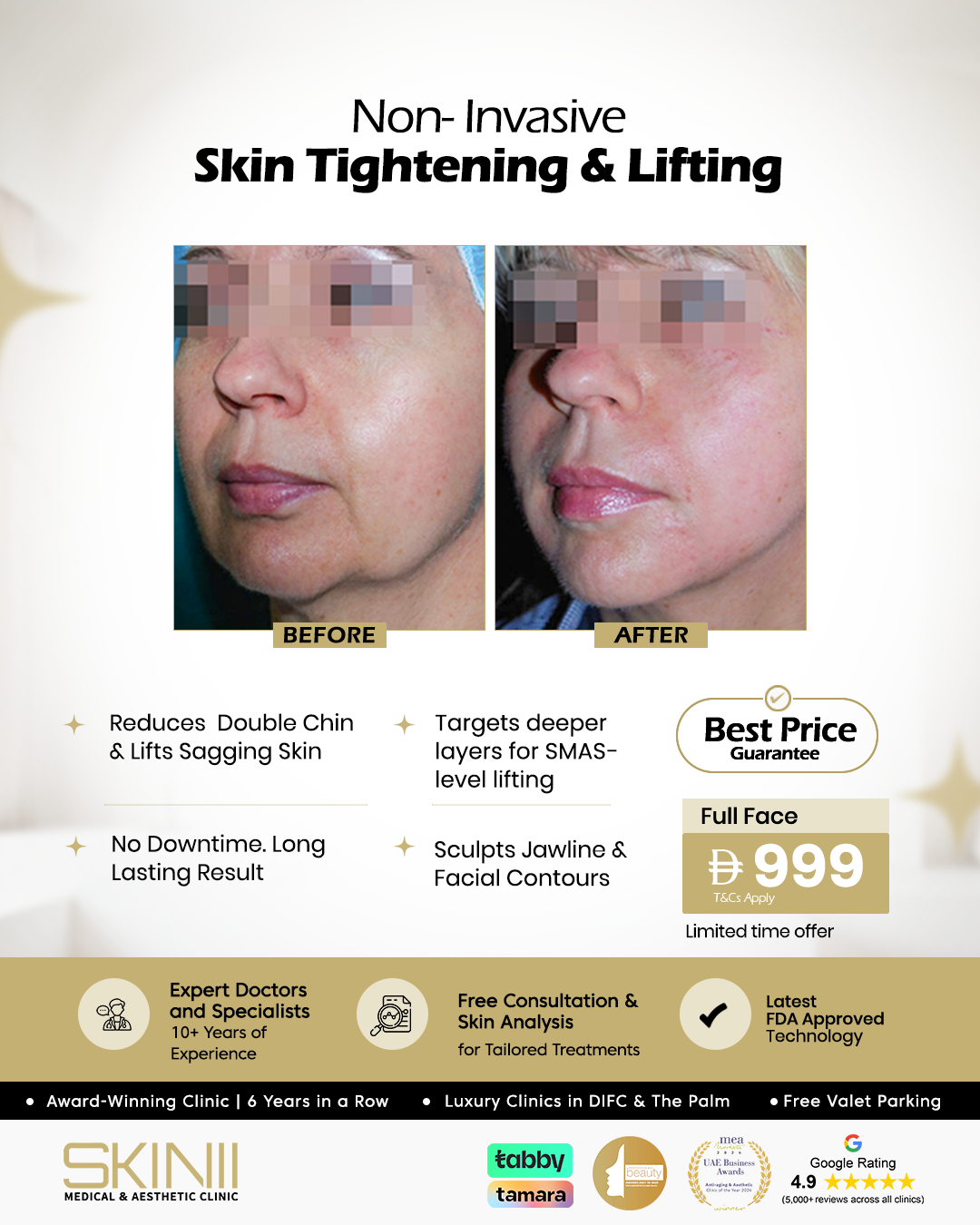 Skin111 Clinics Facebook ad from Jun 22, 2026