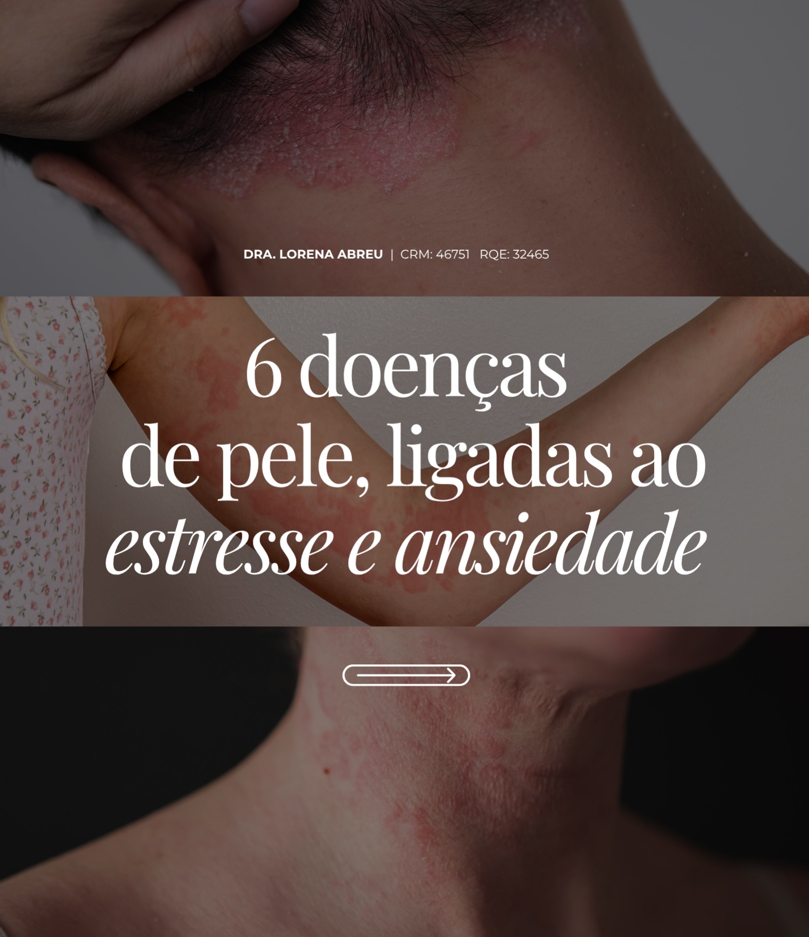 Lorena Dermatologista Facebook ad: A pele é um dos órgãos que mais…
