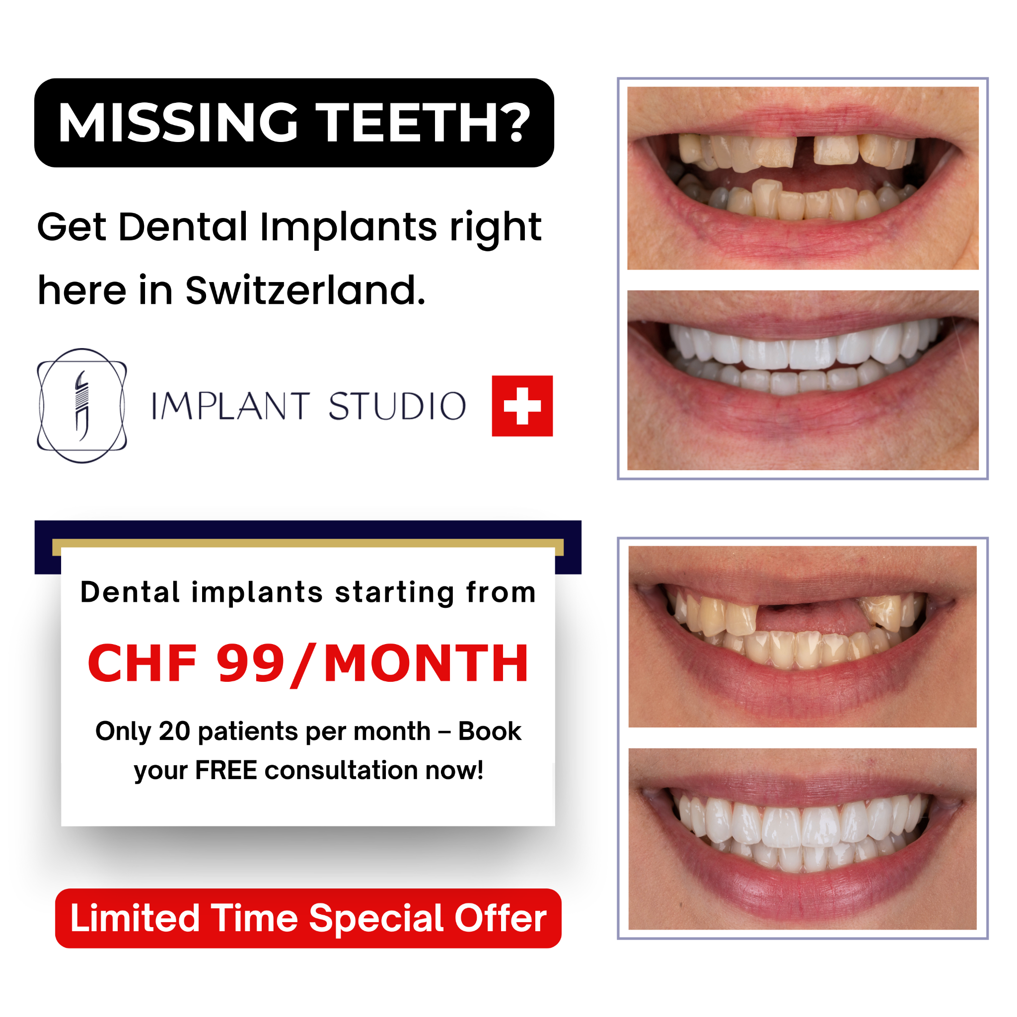 Implant Studio Facebook ad: Implants at CHF 99/Month