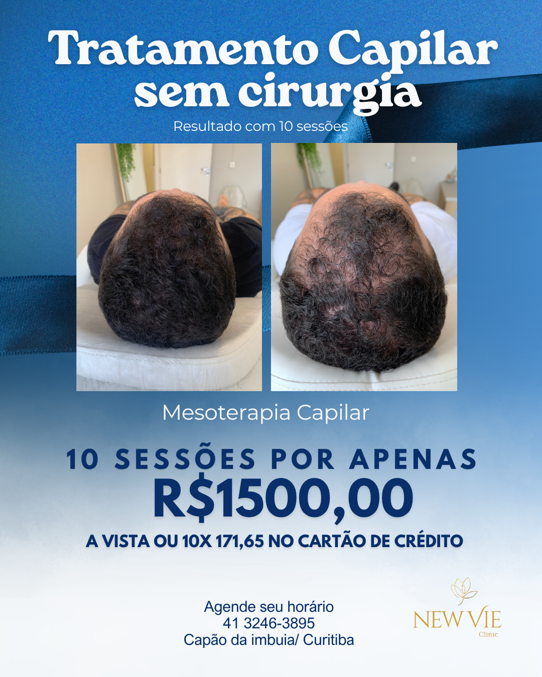 NewVie Clinic Facebook ad
