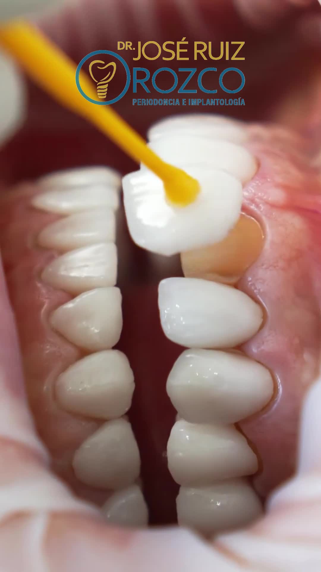 Periodoncia e implantología. Dr Jose Luis Ruiz Orozco Facebook ad: ¿𝘽𝙐𝙎𝘾𝘼𝙎 𝙐𝙉 𝘿𝙄𝙎𝙀𝙉̃𝙊 𝘿𝙀 𝙎𝙊𝙉𝙍𝙄𝙎𝘼?