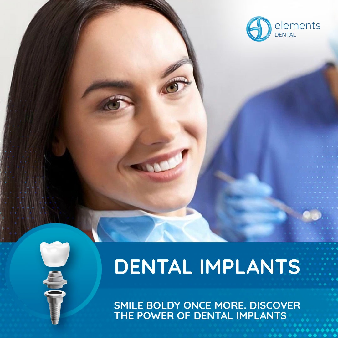 Elements Dental Facebook ad from Dec 9, 2025