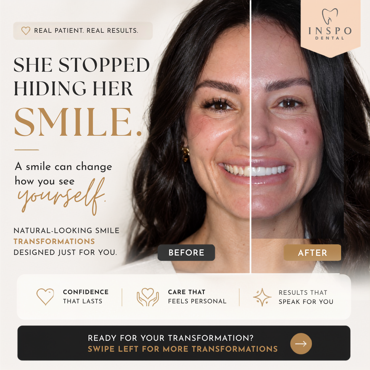 Inspo Dental Facebook ad: You don’t realize how much your smile affects…