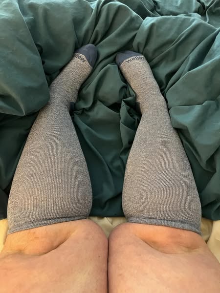 Nicole Parker Facebook ad: Relieve swelling, naturally