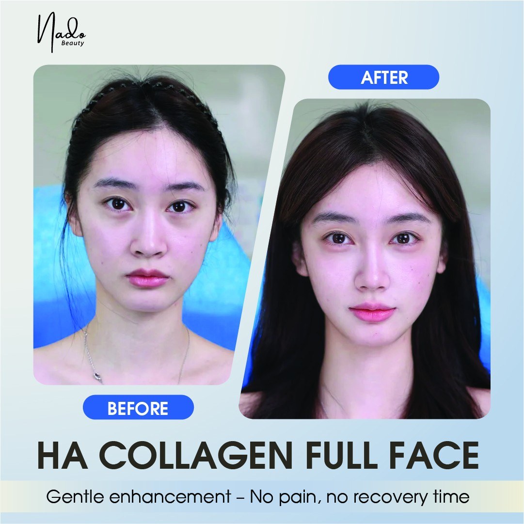 Nado Aesthetic Clinic Facebook ad