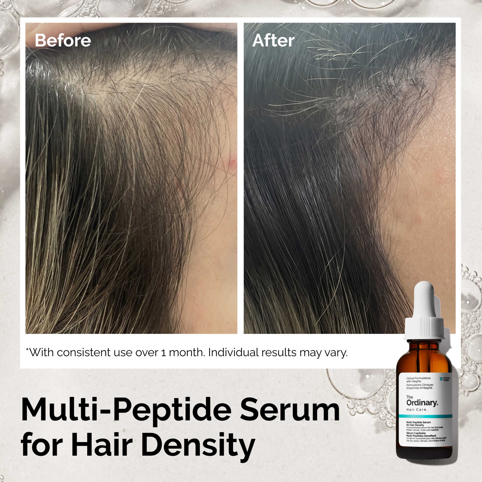 The Ordinary Facebook ad: Peptide Serum for Healthier-Looking Hair