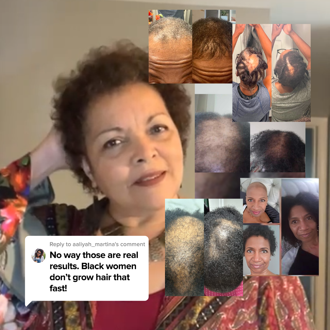 Rennora Beauty Facebook ad