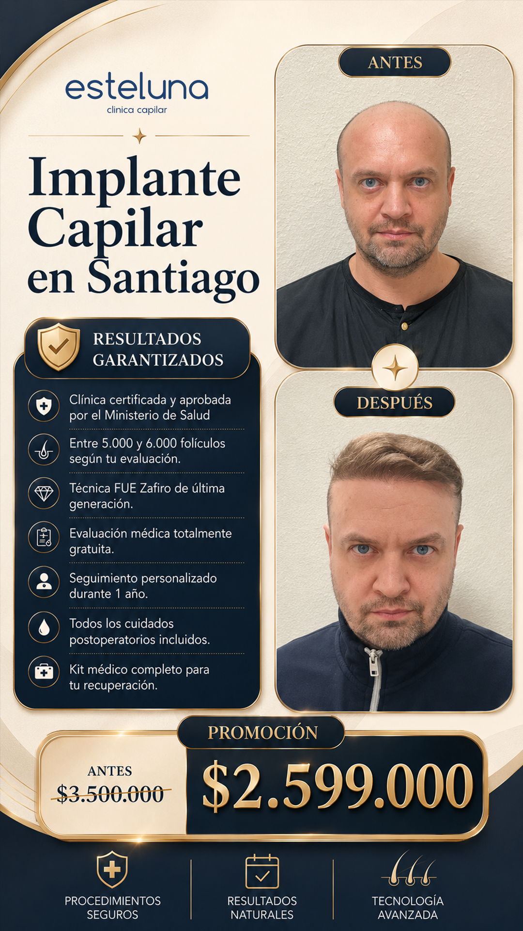 Esteluna Capilar Facebook ad: ¿Sientes que la caída del cabello ha empezado…