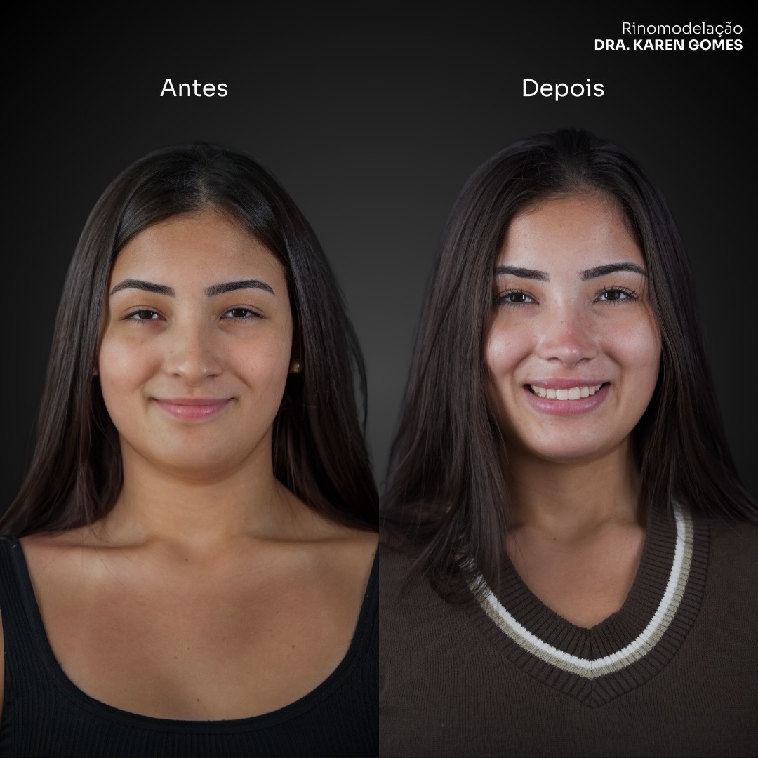 Clínica Karen Gomes Facebook ad: Com a técnica certa o resultado fica impecável…