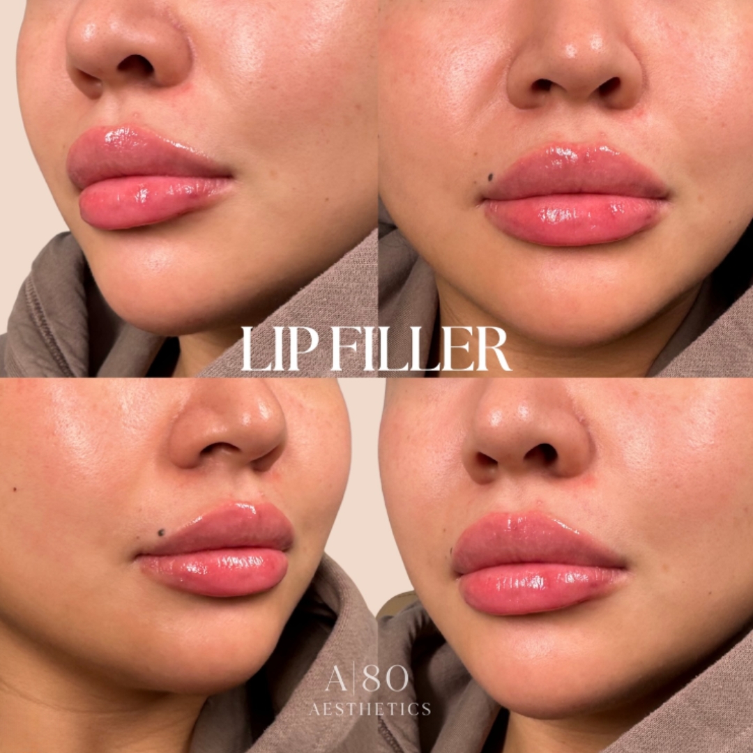 Aurora 80 Medical Aesthetics Facebook ad
