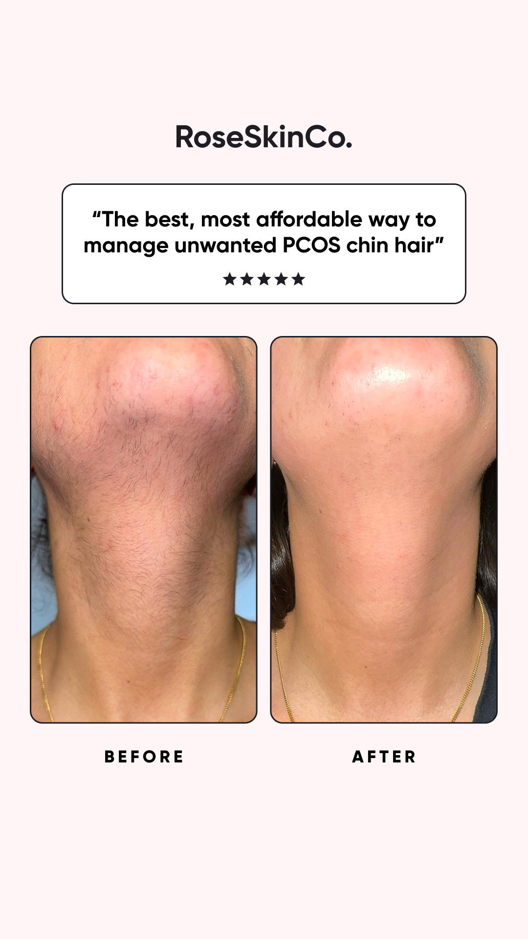 Rose Skin Co Facebook ad