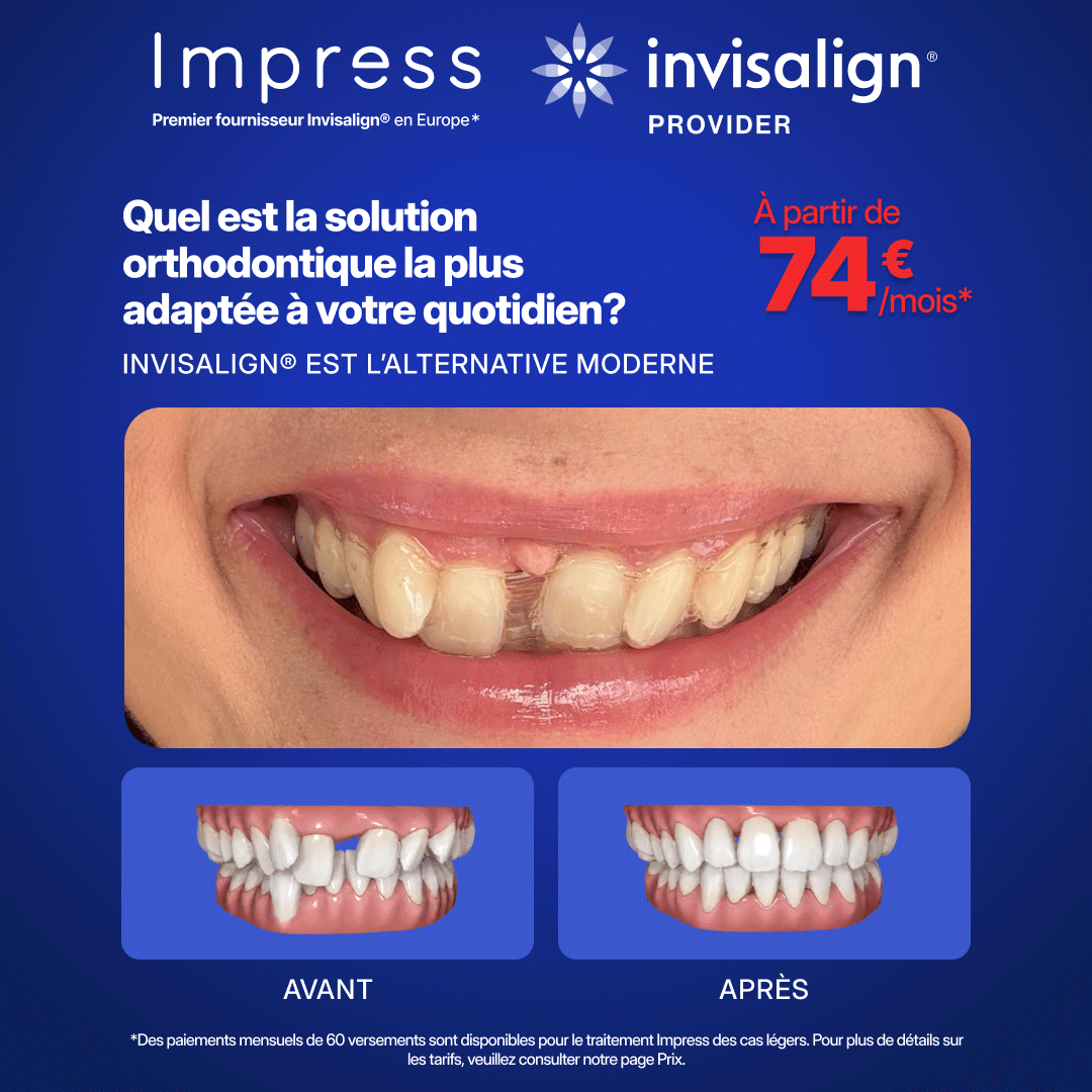 Impress_fr Facebook ad from Jul 27, 2026