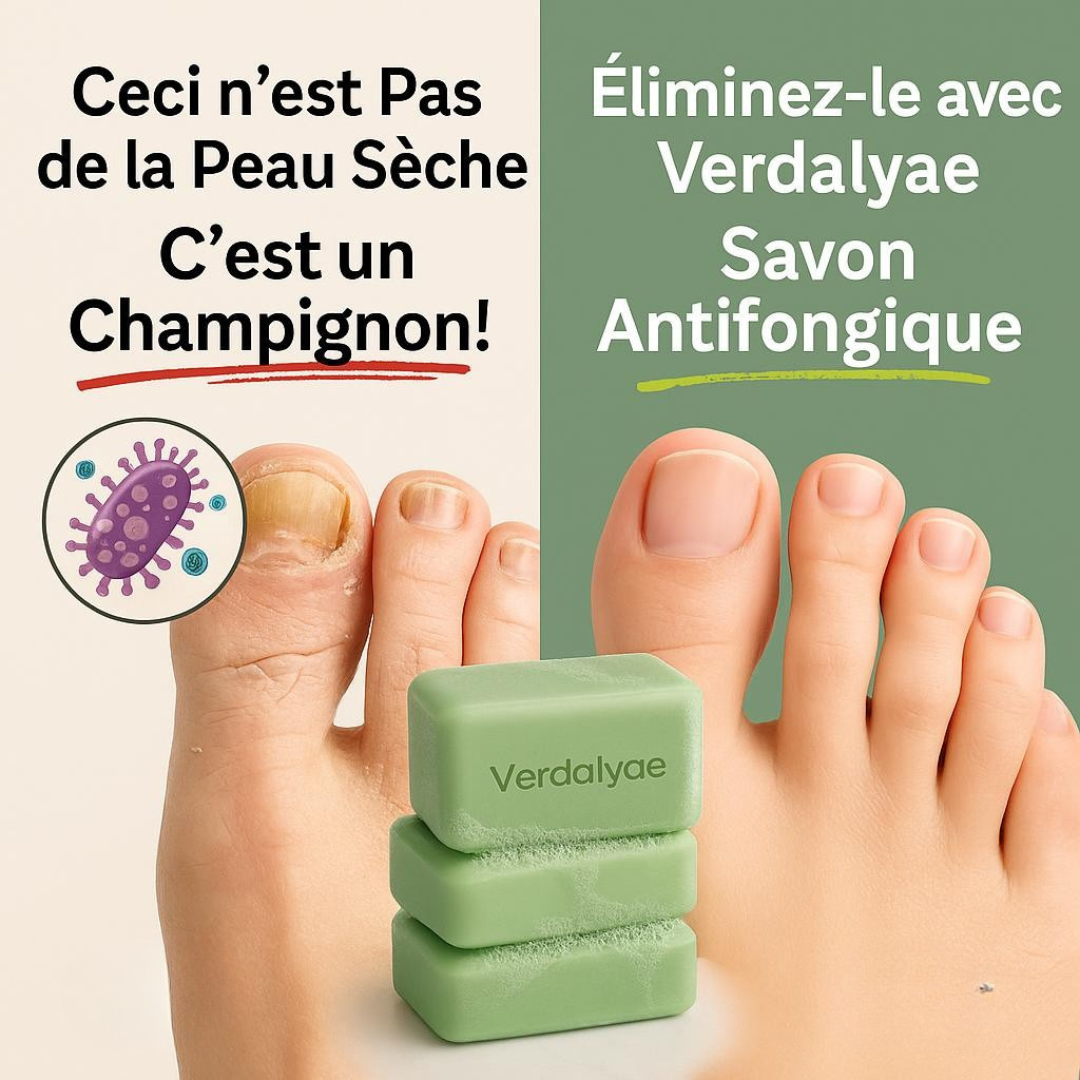 Verdalyae Facebook ad
