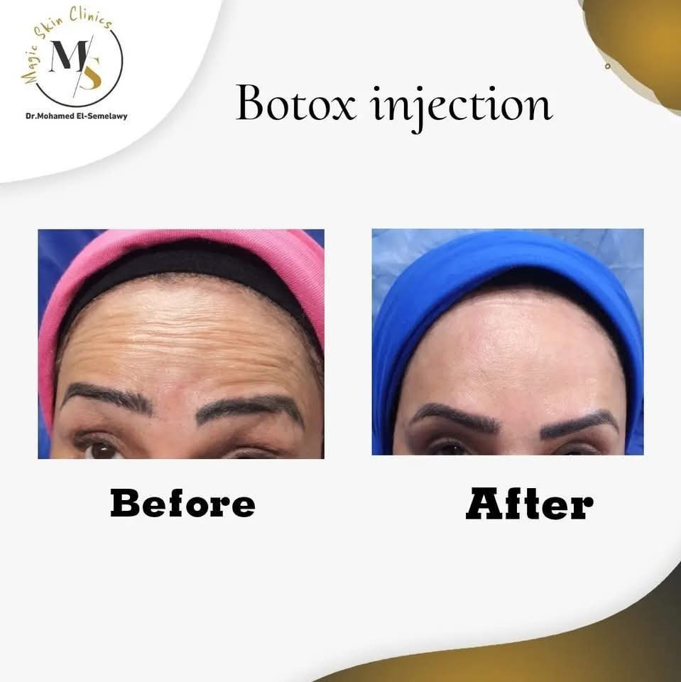 Magic skin clinics Facebook ad