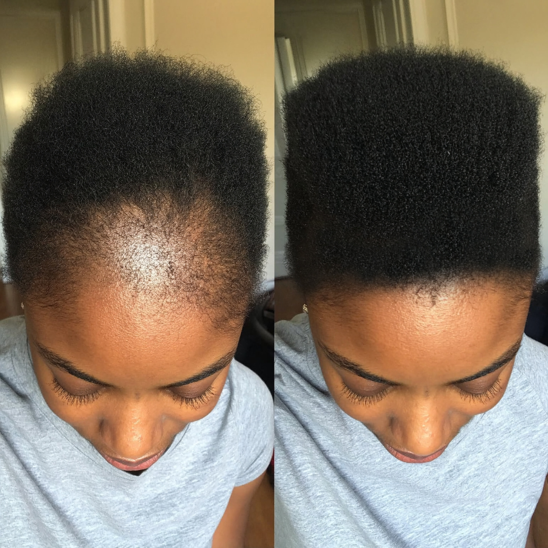 Keisha's Hair Journey Facebook ad