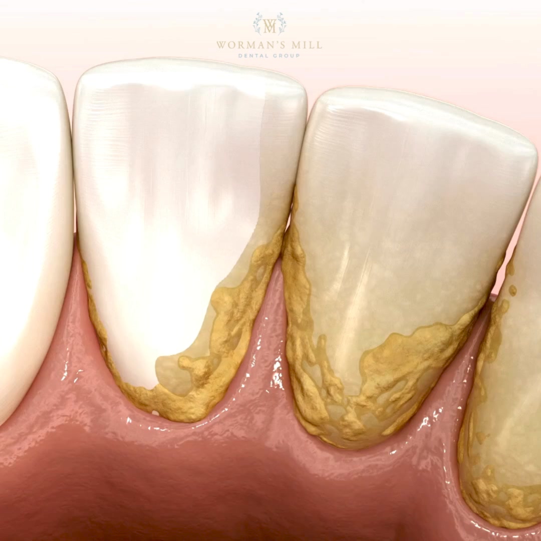 Worman's Mill Dental Group Facebook ad: Family Dentistry in Fredrick, MD