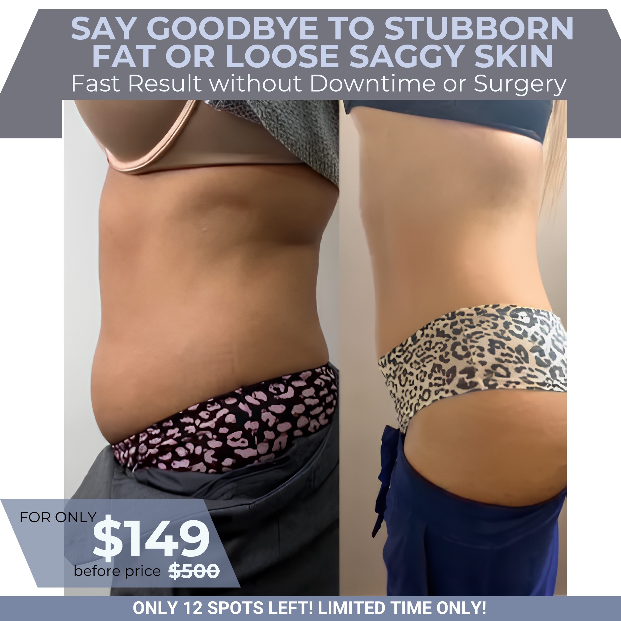 US Cryotherapy - Fort Hood Facebook ad: From $500 to $149 Real Results Start Here!