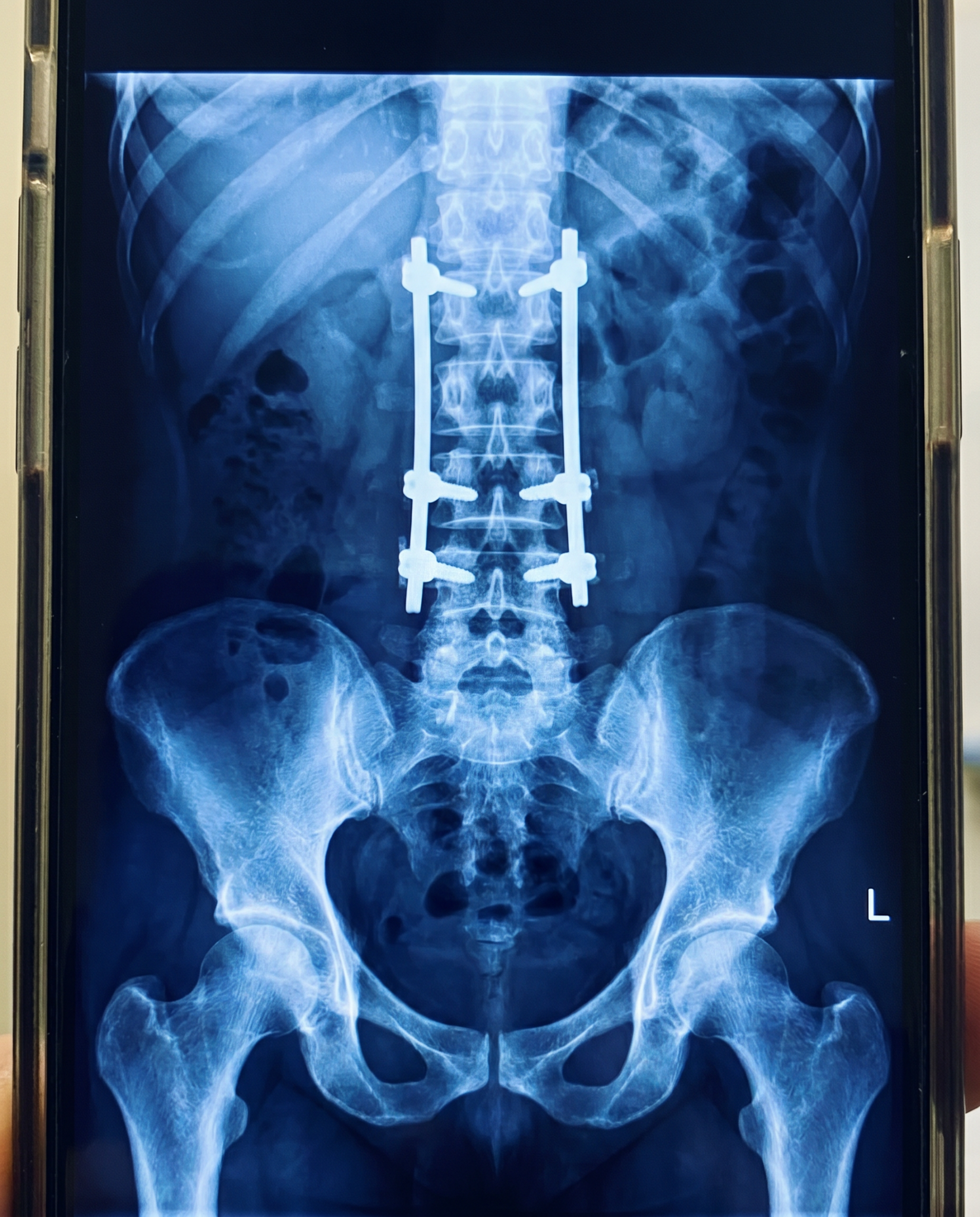Sabine Koch Facebook ad: Was dir Orthopäden NICHT erzählen!