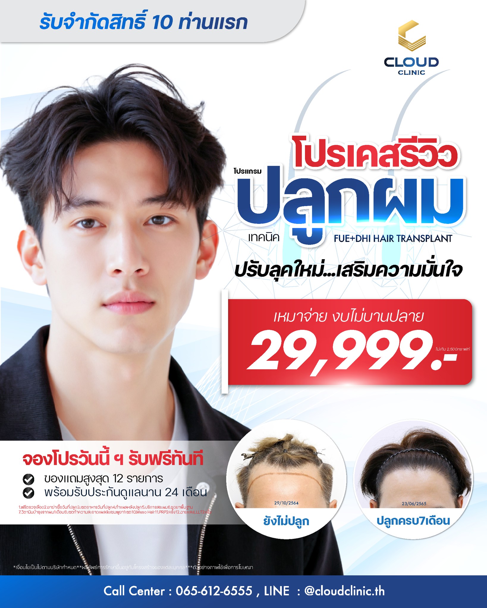 Cloud Clinic คลาวด์คลินิก:โปรแกรมปลูกผม DHI FUT FUE Micrograft Longhair Facebook ad: ปรับลุคเปลี่ยนสไตส์ ให้คุณดูหล่อเท่ห์ มั่นใจขึ้น
