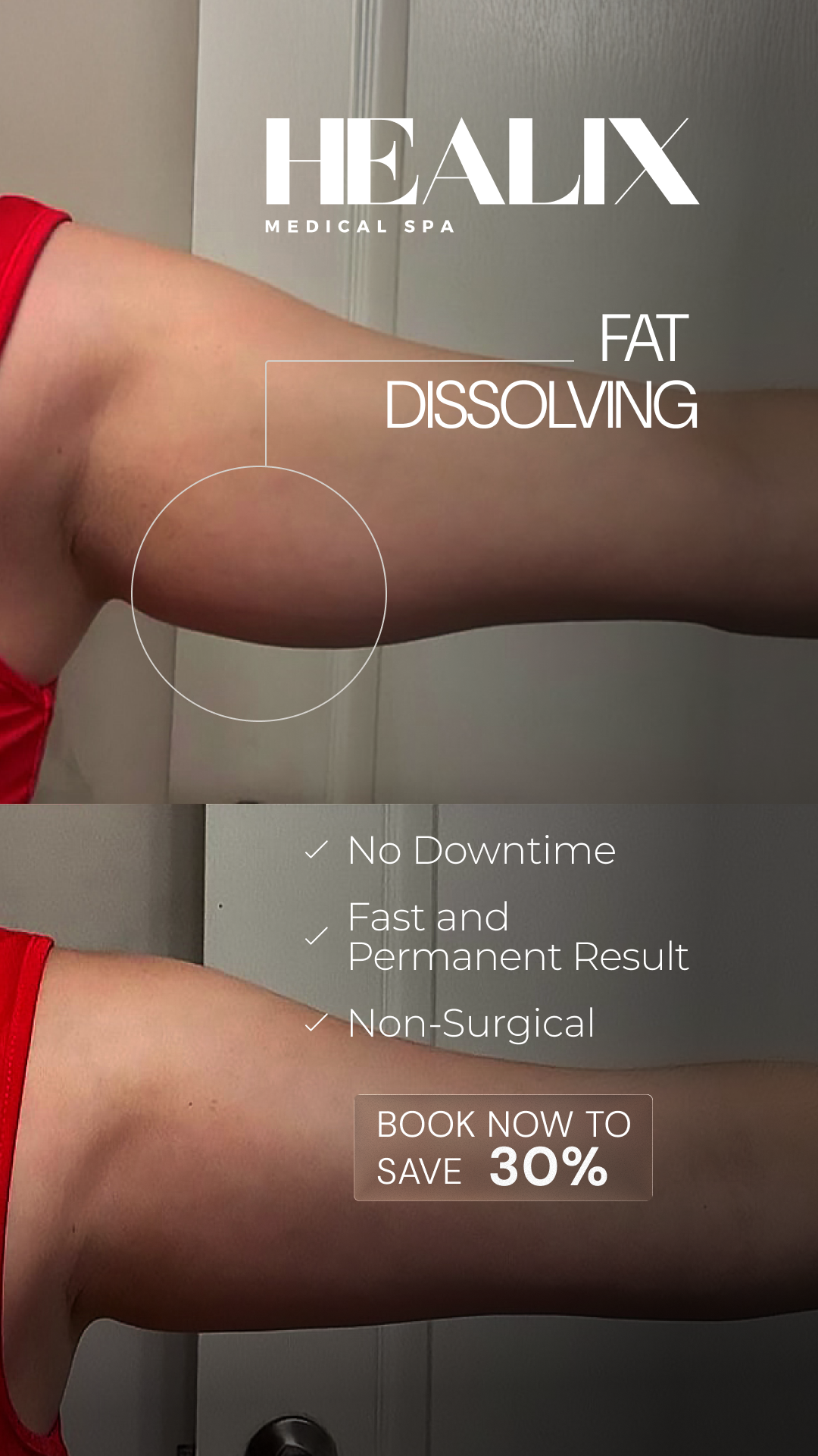 Healix Medical Spa Facebook ad from May 9, 2026