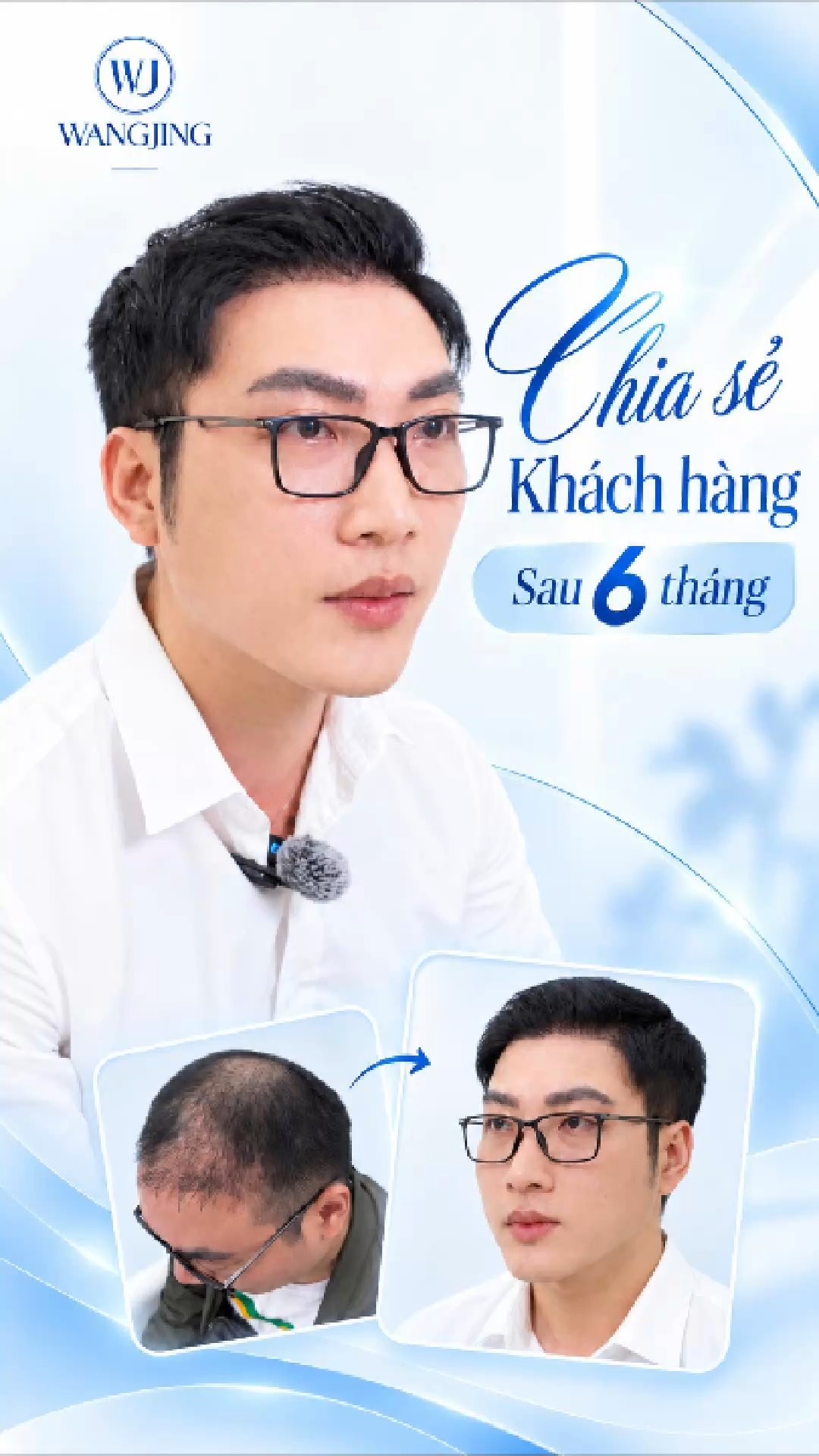 Viện Cấy Tóc Tự Thân WangJing DNA BioHair Facebook ad: LẤY LẠI PHONG ĐỘ SAU 6 THÁNG CẤY…