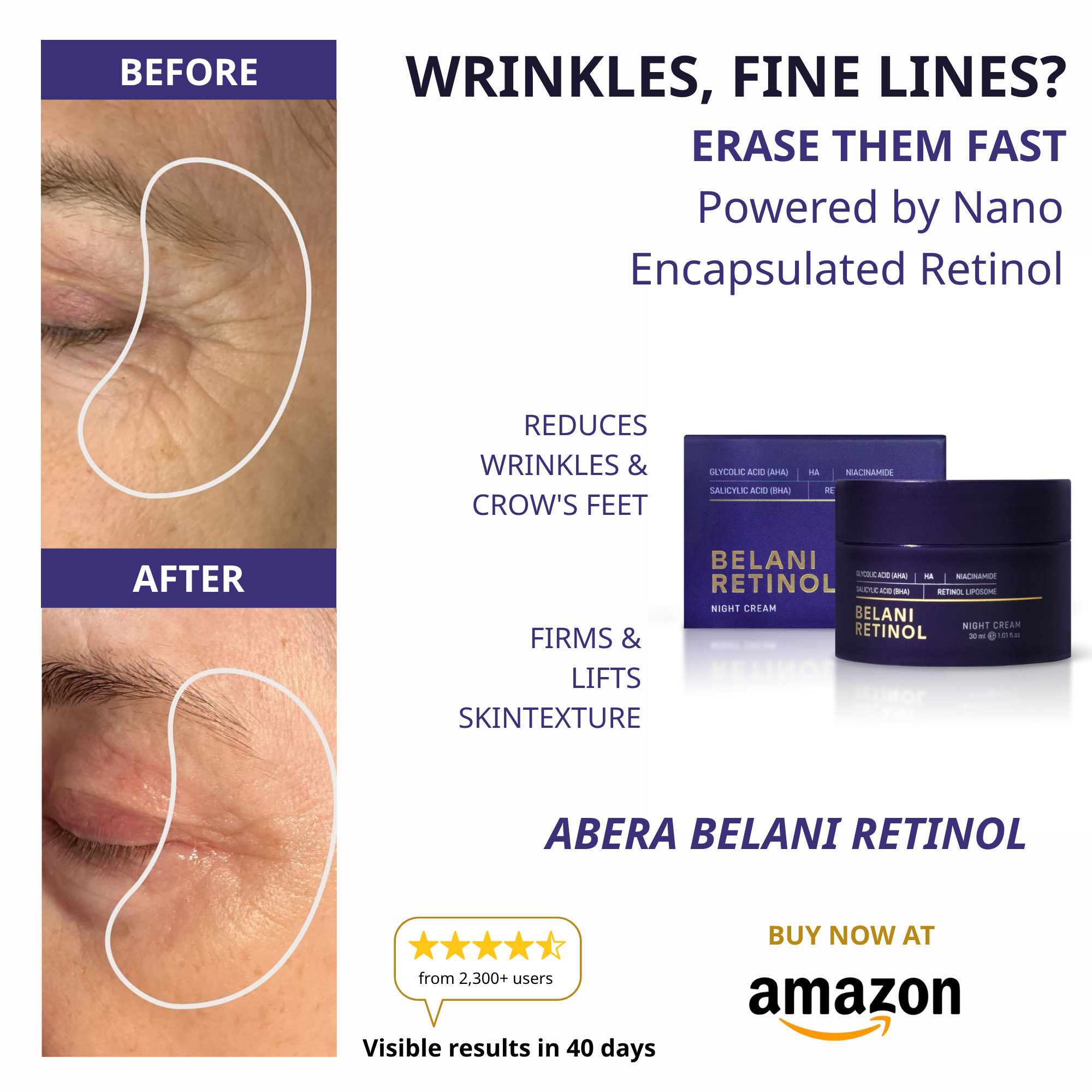 Belani Retinol Cream Facebook ad: Available on Amazon! Free Shipping & 30-days Risk-Free