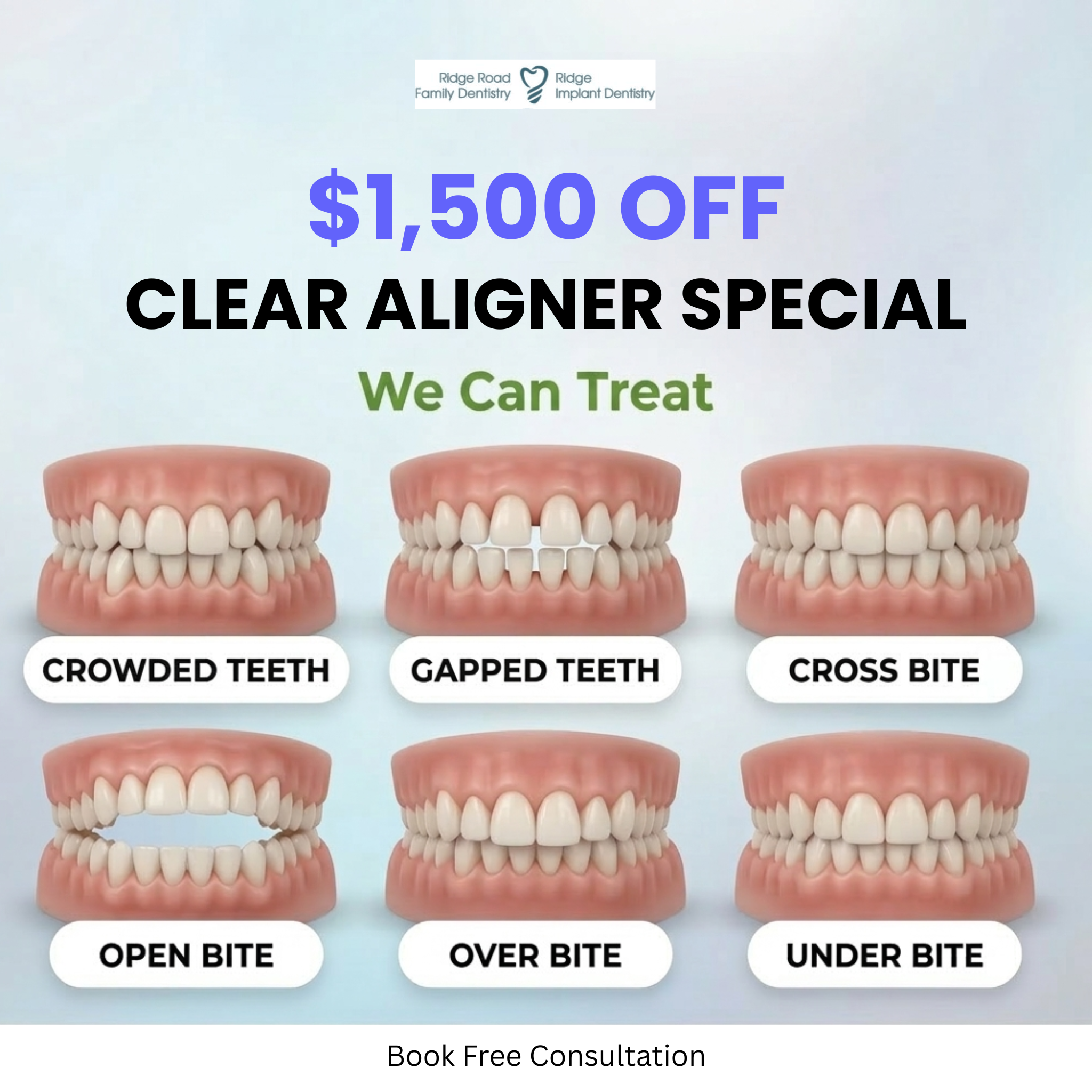 Ridge Road Family Dentistry Facebook ad: Hey Cleveland! New Year Special $1500 OFF Clear Aligner is…