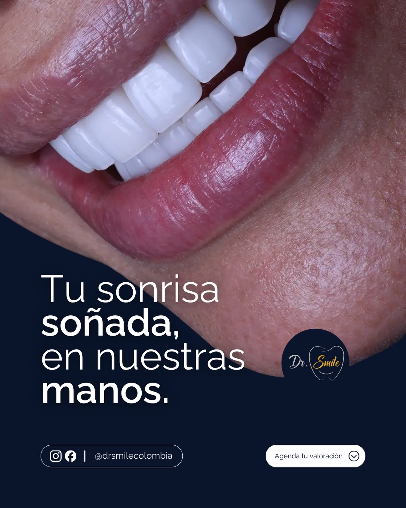 Dr. Smile Colombia Facebook ad