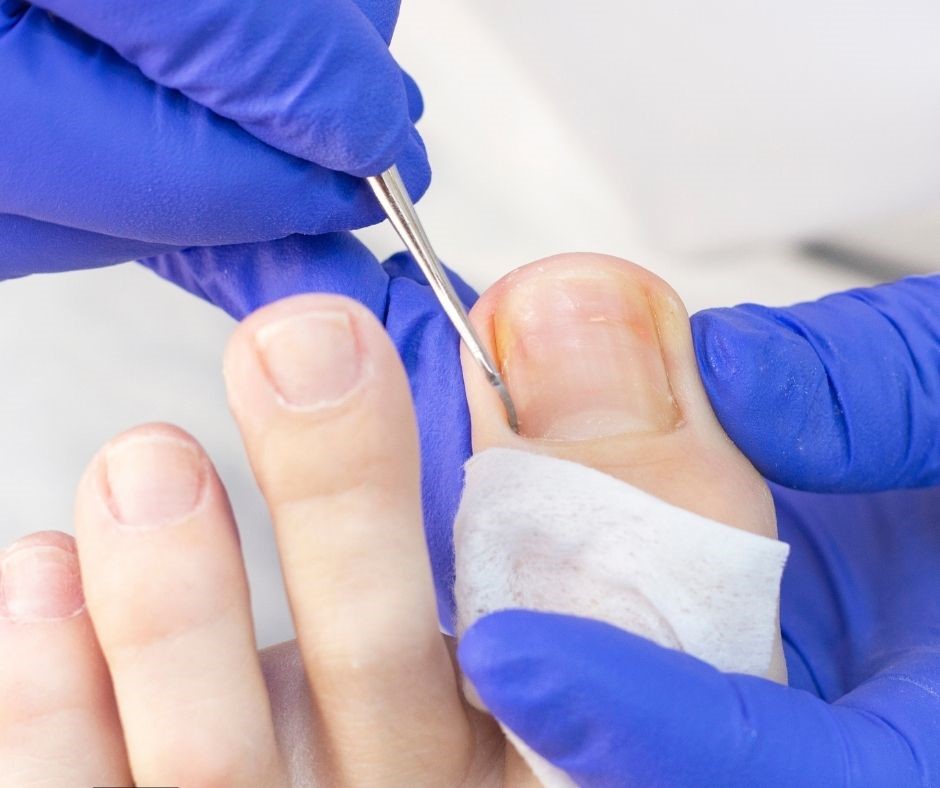 Falcon Yard Podiatry UK Facebook ad
