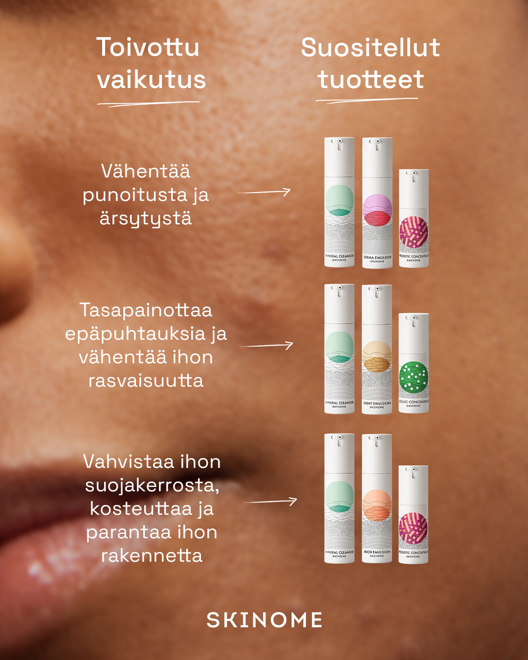 Skinome Facebook ad