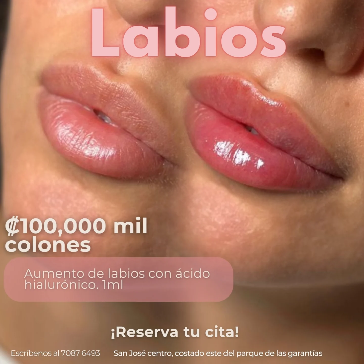 Mily La Esthetic Facebook ad: LABIOS, RINOMODELACIÓN, BOTOX, CEJAS Y MÁS.