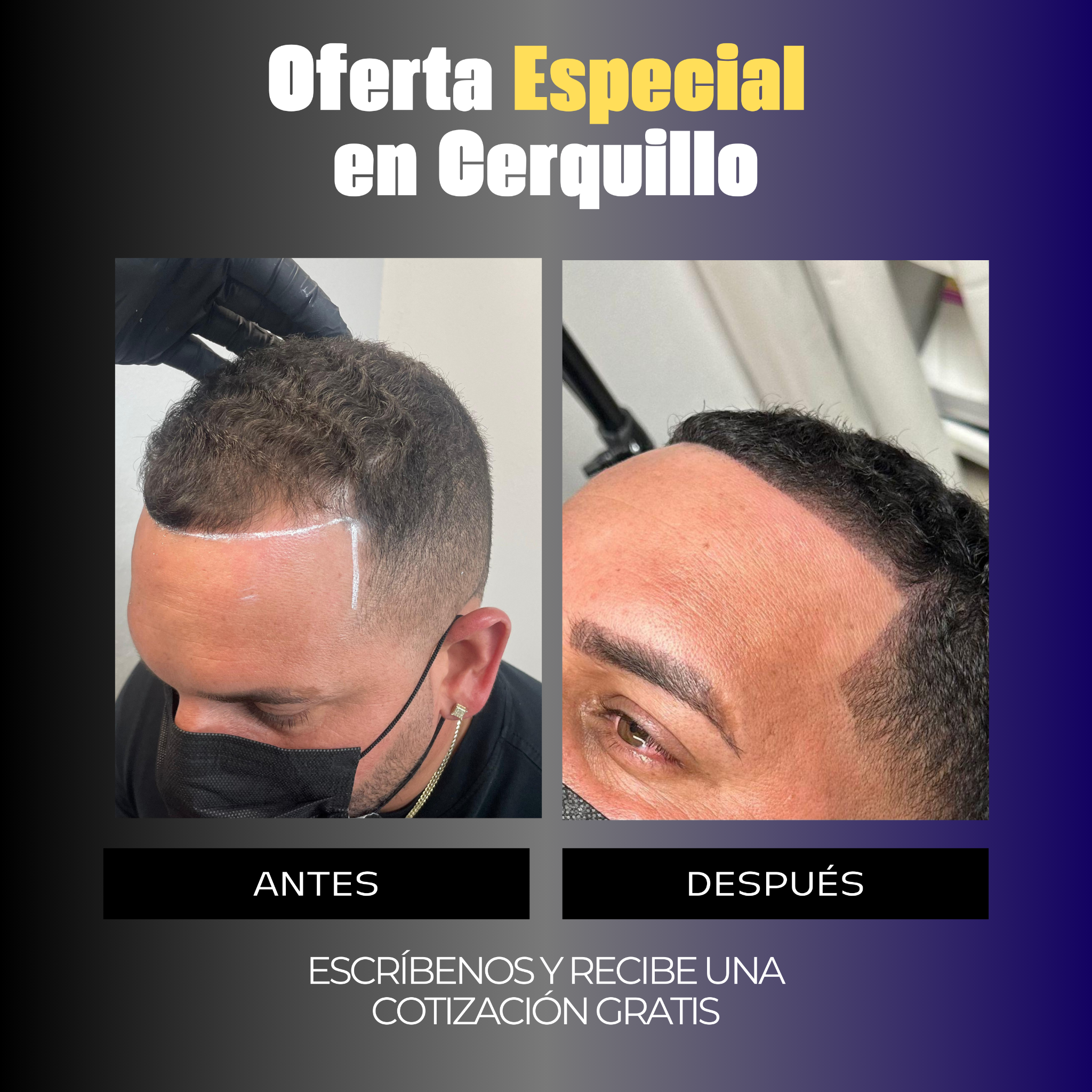 Enrique Micro Artista Facebook ad: Más Información
