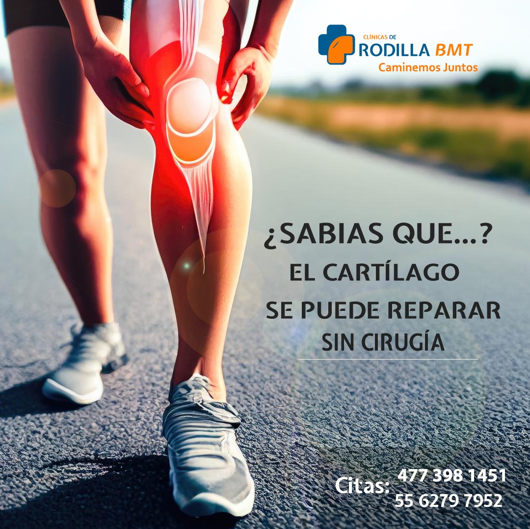 Clínicas de Rodilla BMT León Gto Facebook ad: Reparación de cartílago