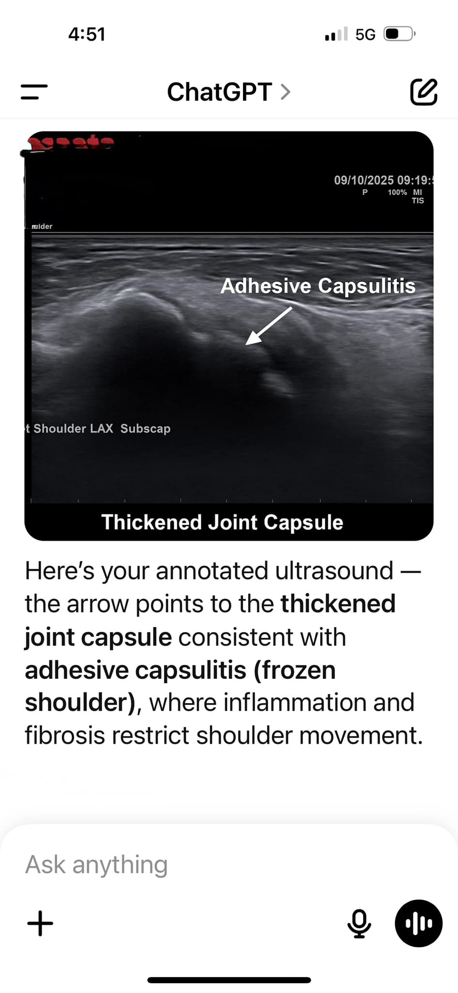 Sarah Mitchell Menopause Joint Expert Facebook ad