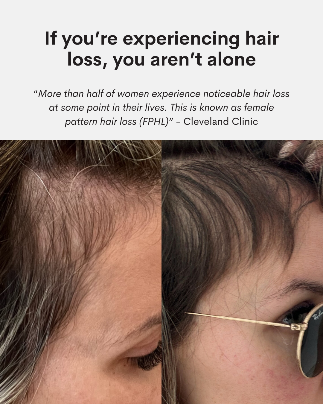 Lacy Gadegaard-West Facebook ad: Deep Nourishment for Silky, Strong, Luminous Hair