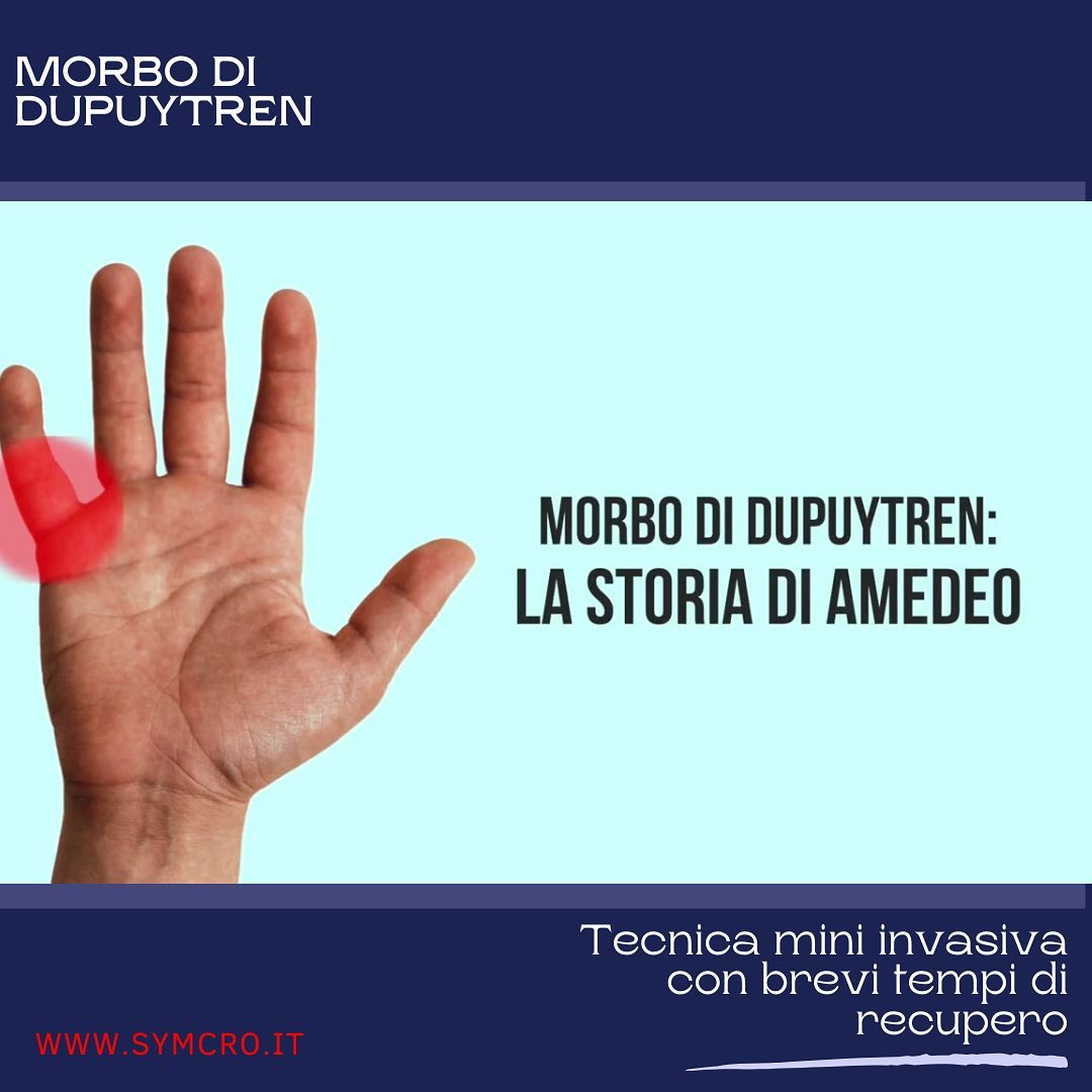 Symcro - Professionisti arto superiore Facebook ad: Nessuna cicatrice, nessun intervento e un recupero veloce.