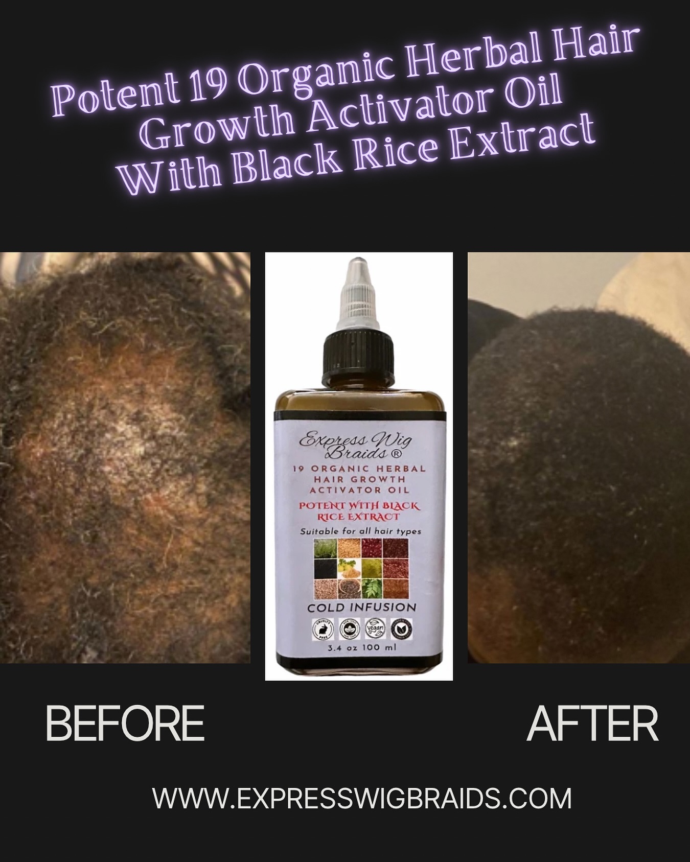 Express Wig Braids Facebook ad: Organic Hair Growth Oil For Alopecia, Rosemary Hair Growth…