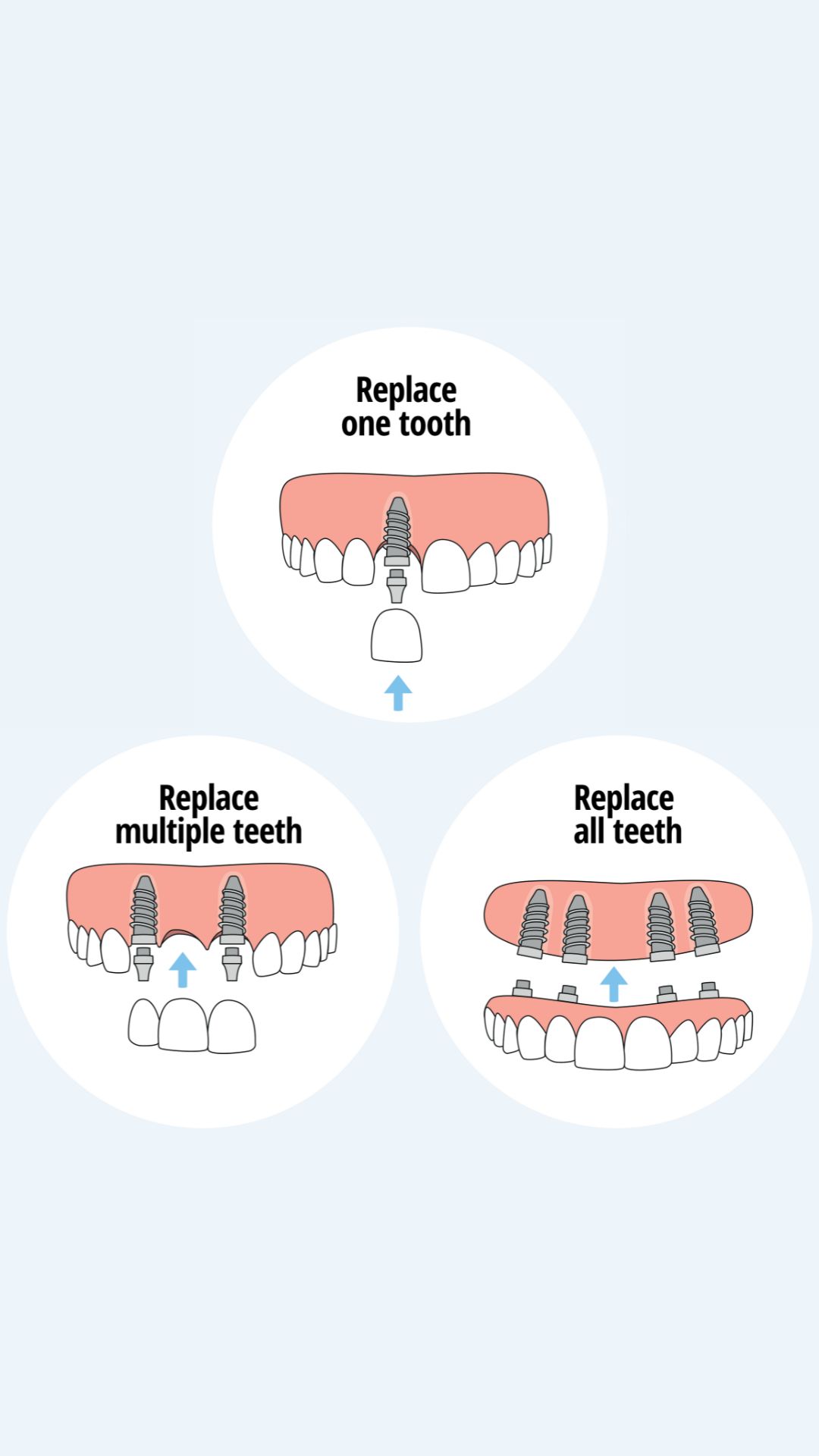 Abbey House Dental Facebook ad from Jun 22, 2026