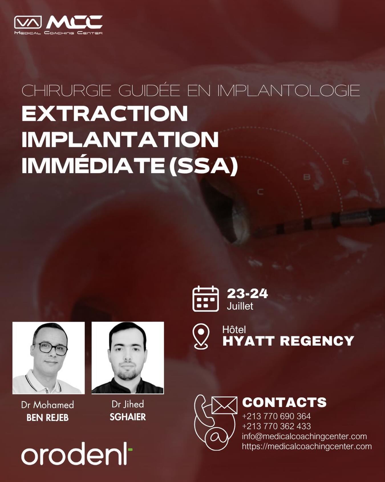 Medical Coaching Center Facebook ad: Extraction Implantation Immédiate (Approche Classique et…