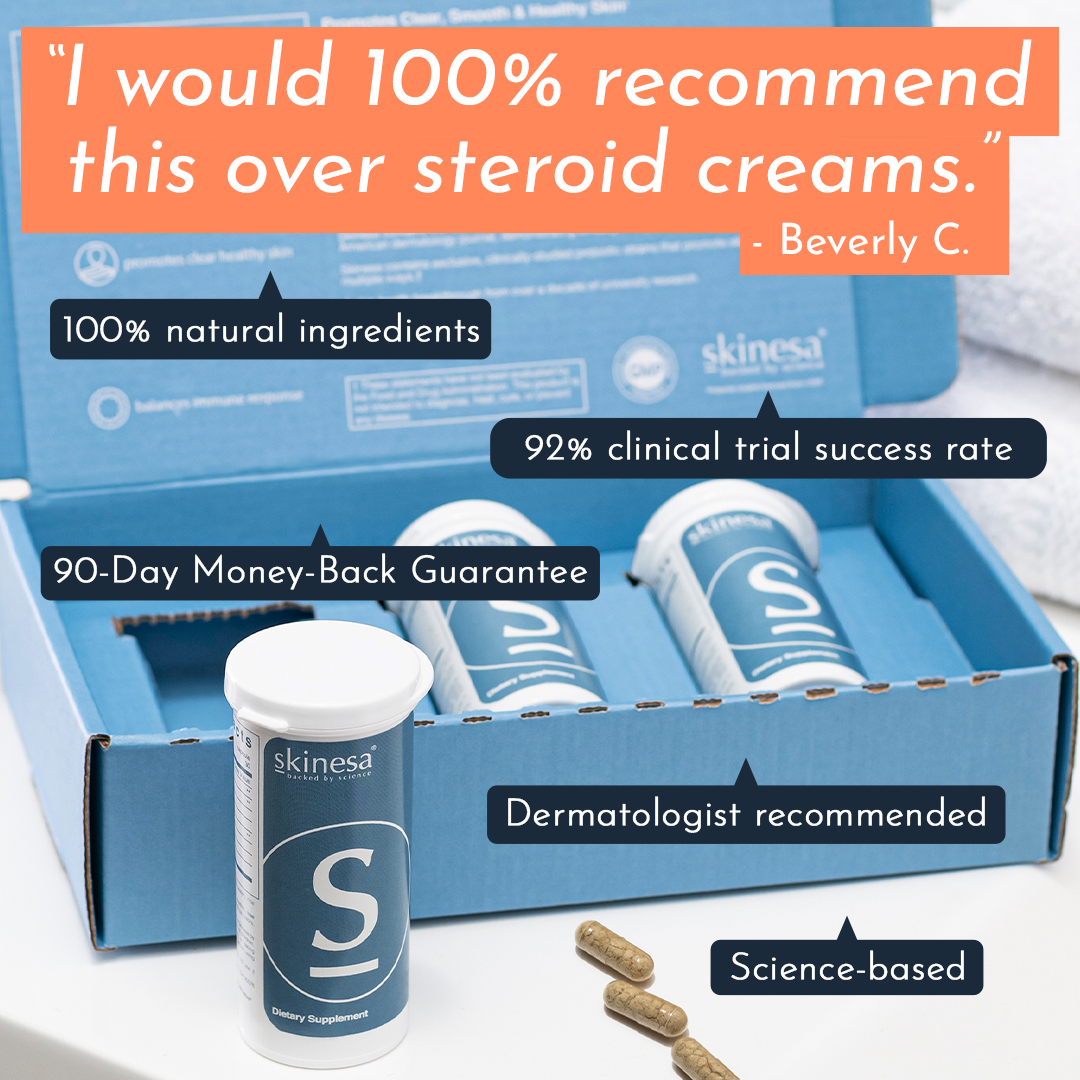 Skinesa Facebook ad