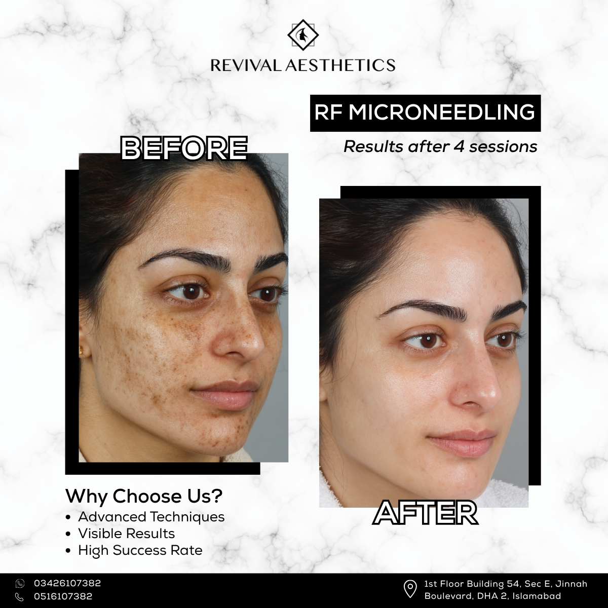 Revival Aesthetics Facebook ad