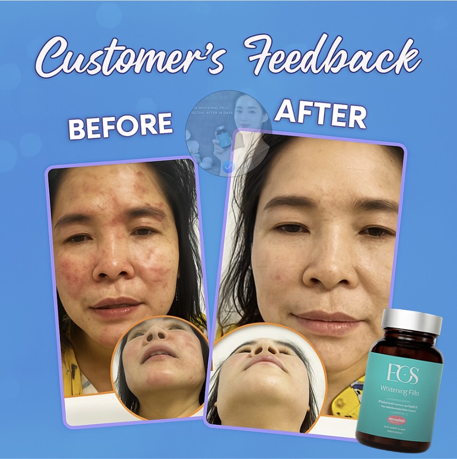 Eos Whitening Pills - Effective after 14 days Facebook ad